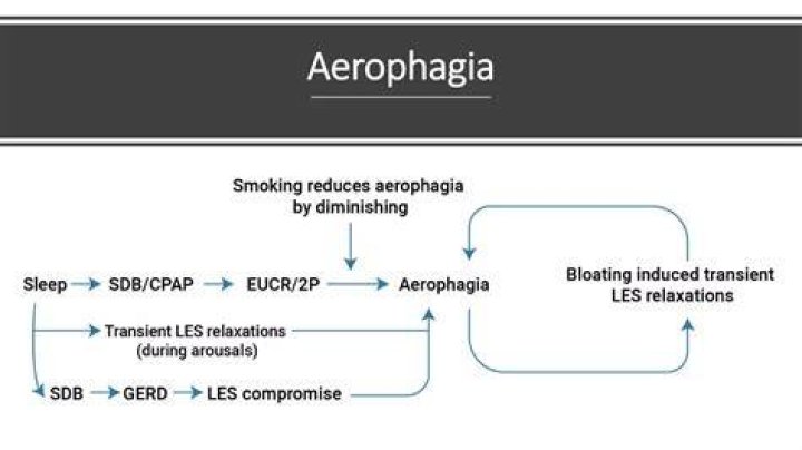 Is aerophagia serious